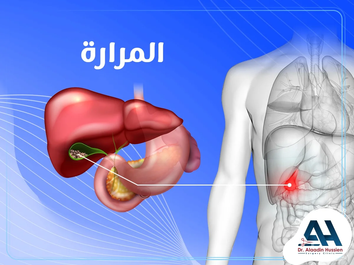 المرارة أو الحويصلة الصفراوية