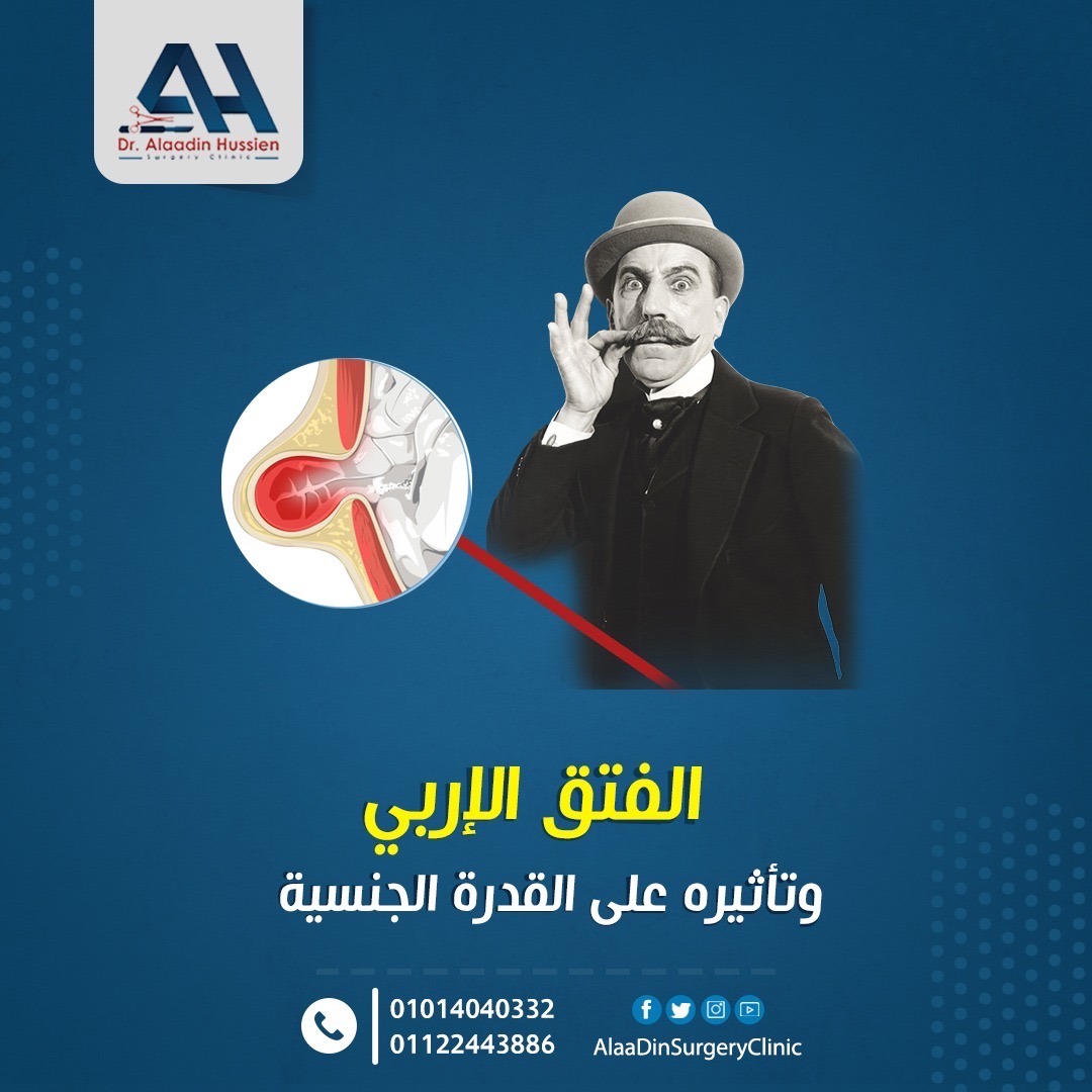 الفتق الأربي والتأثير علي القدرة الجنسية