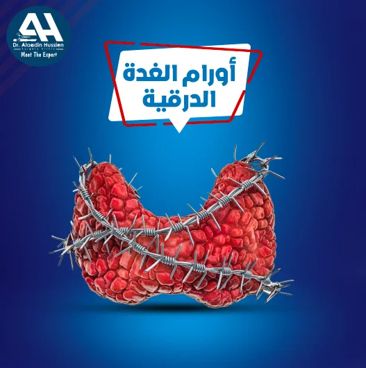 أ.د علاء الدين حسين جراح غدة درقية