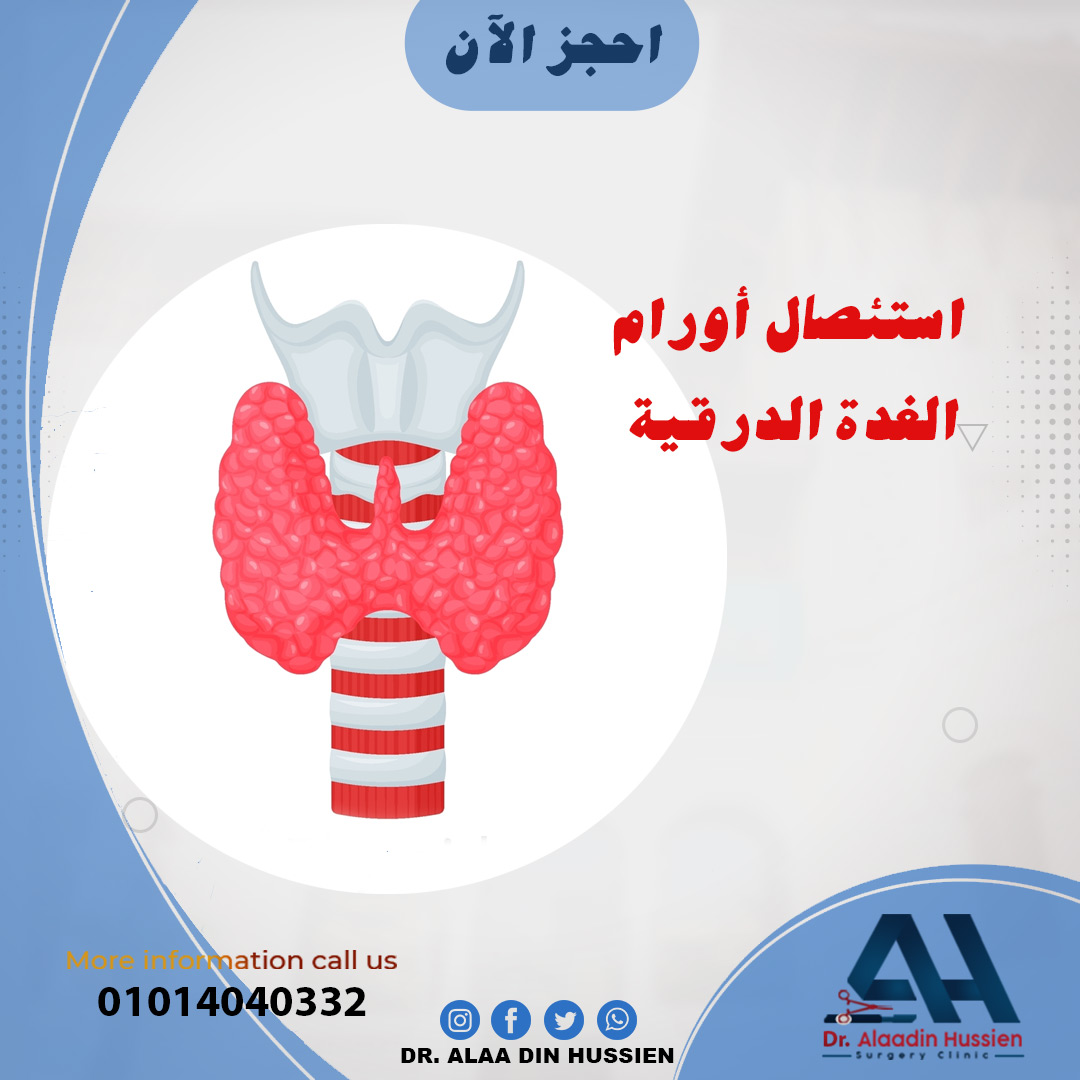 الغدة الدرقية
