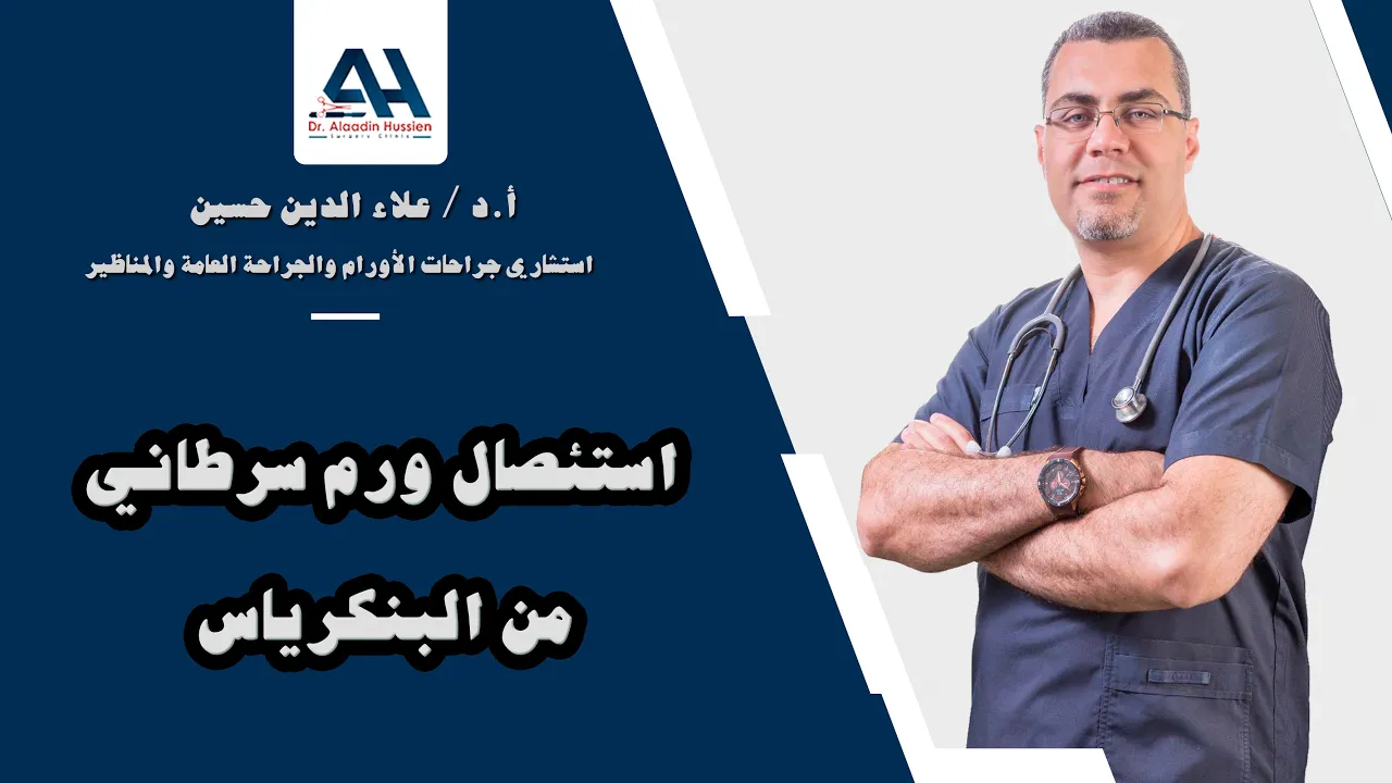 استئصال ورم سرطاني من البنكرياس