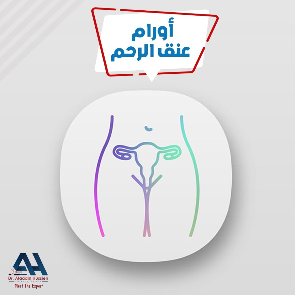 سرطان عنق الرحم