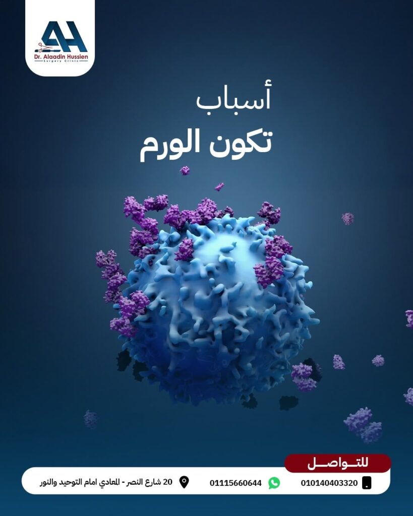 الفرق بين الورم الحميد والخبيث