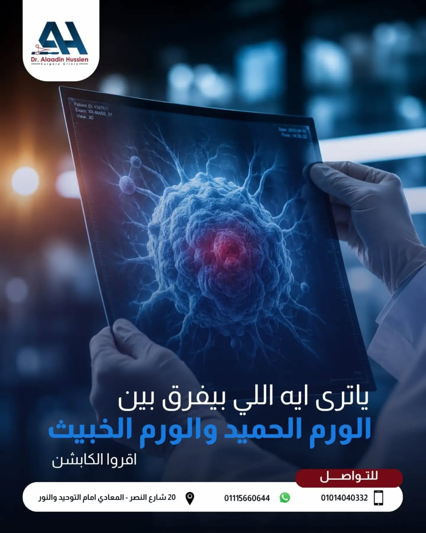 الفرق بين الورم الحميد والخبيث