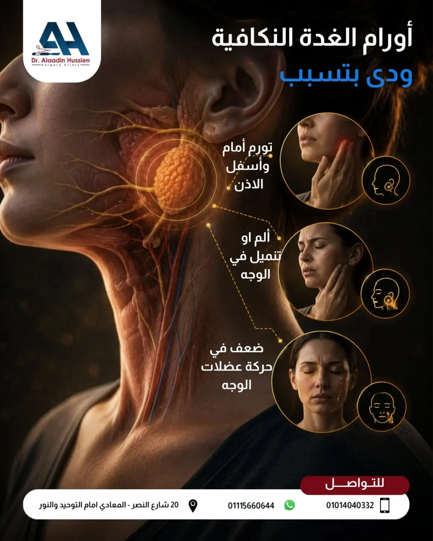 الغدة النكافية