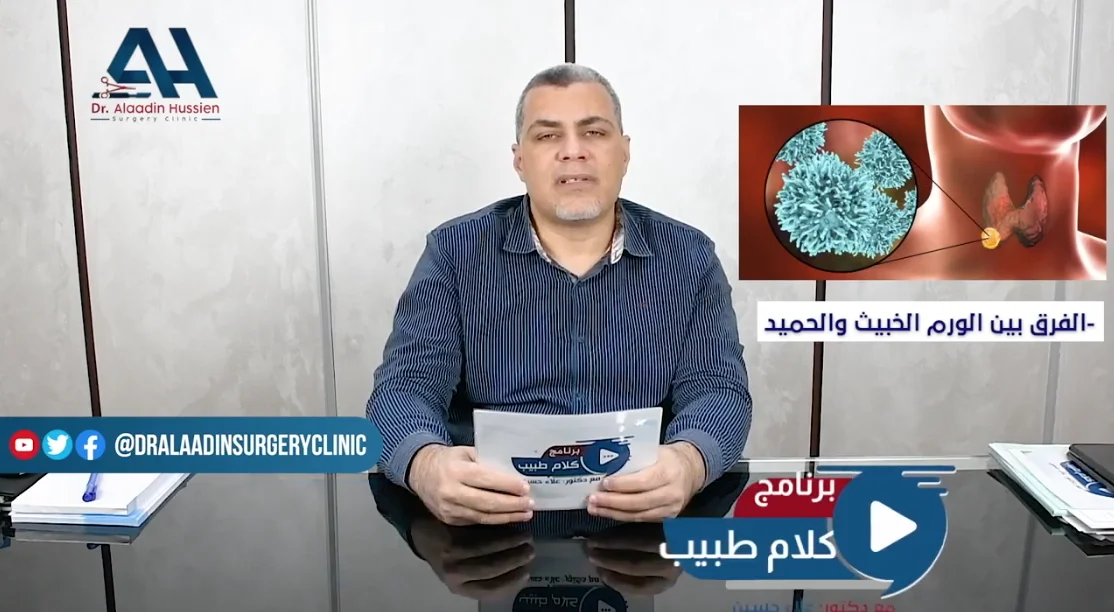 نسبة الأورام الحميدة في الغدة الدرقية