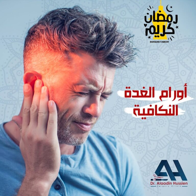 علاج اورام الغدة النكافية