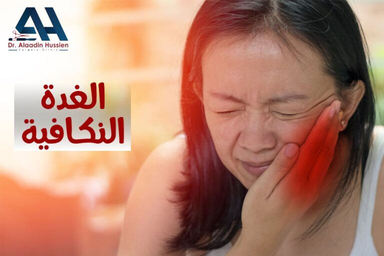 علاج اورام الغدة النكافية