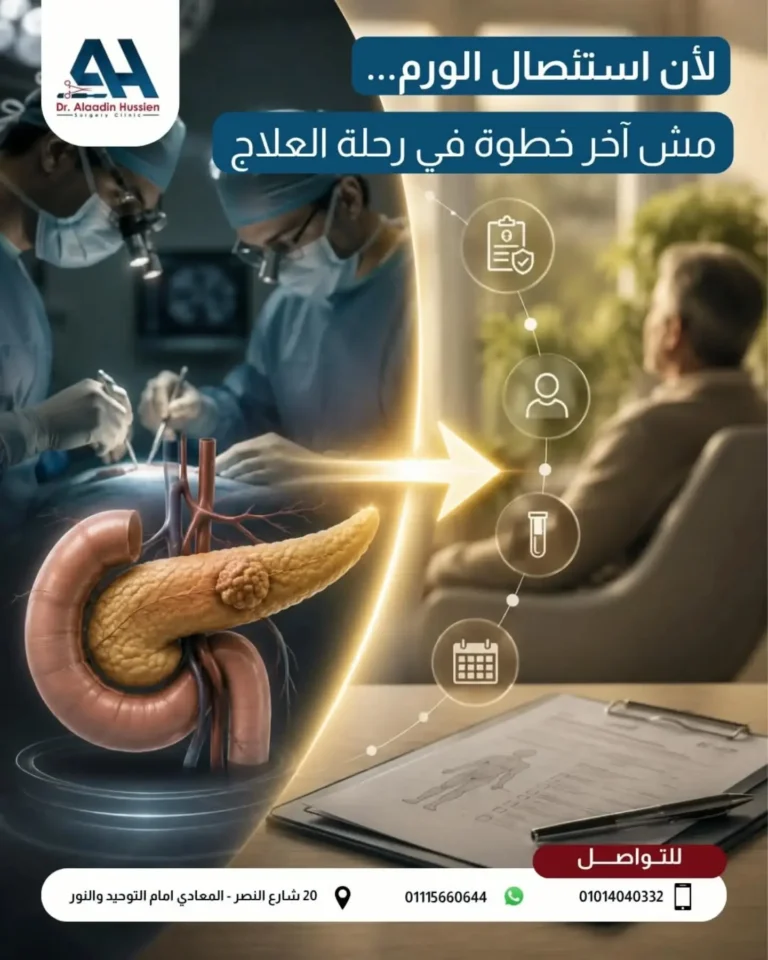 أسباب صعوبة جراحة أورام البنكرياس
